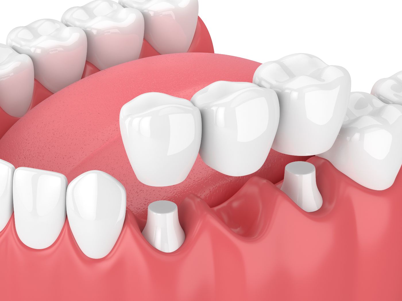 5f442578b4691215a84e394a AdobeStock 198830090 - JAX Dental Studio