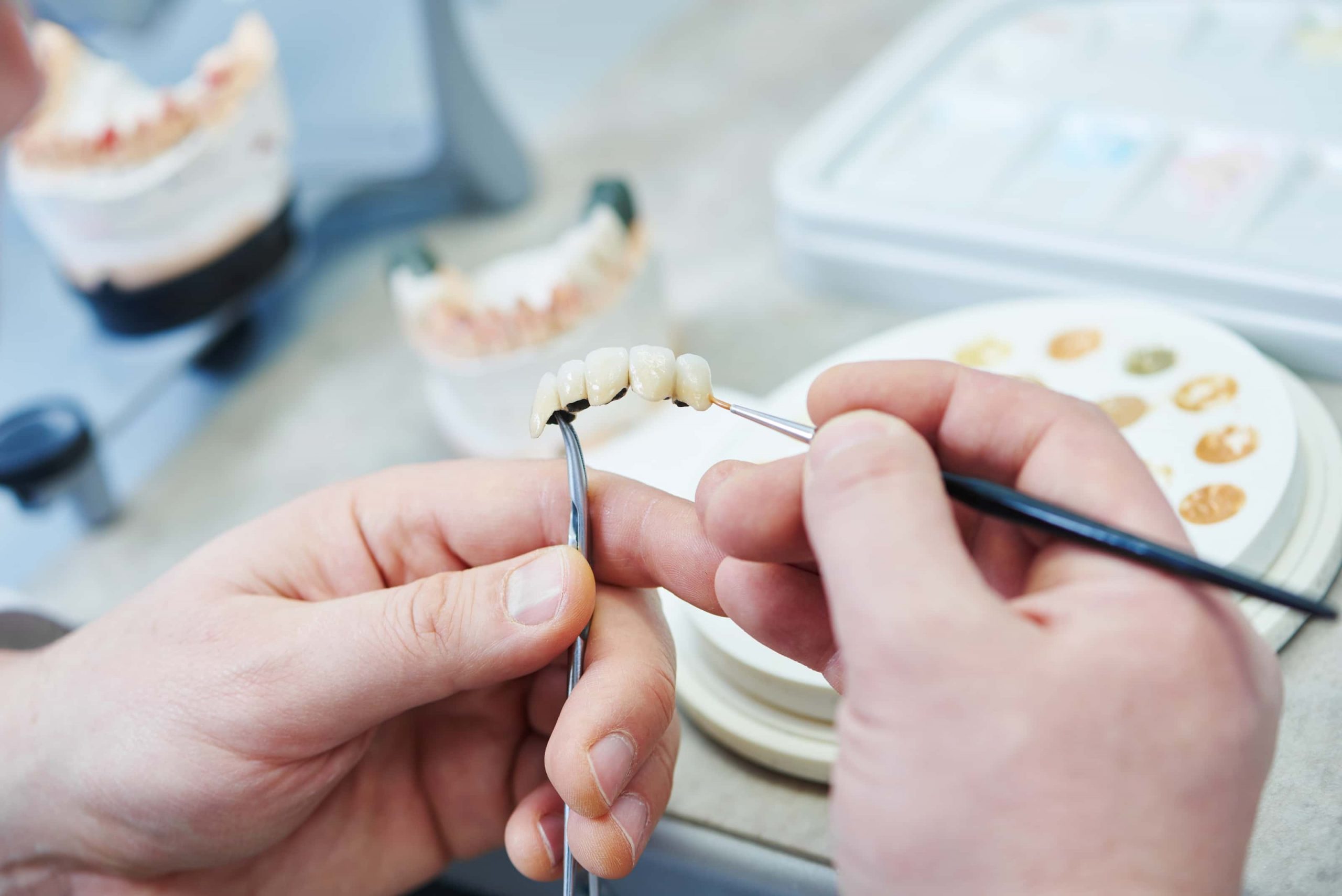 5f443ab7198ba20a7be5d15f AdobeStock 176889342 p 3200 scaled - JAX Dental Studio