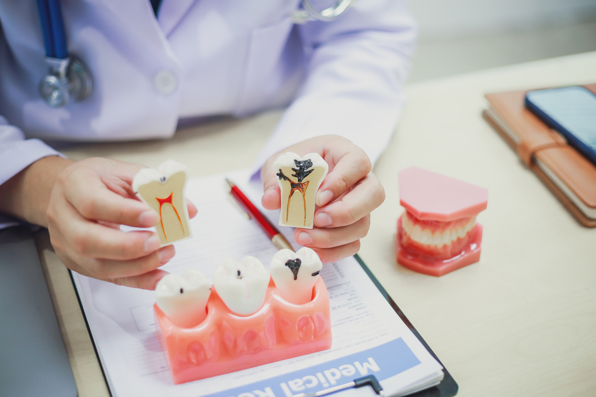 Dentures, dentures in the jaw, root canal treatment, gum disease, tooth models for dentists who are studying dentistry.