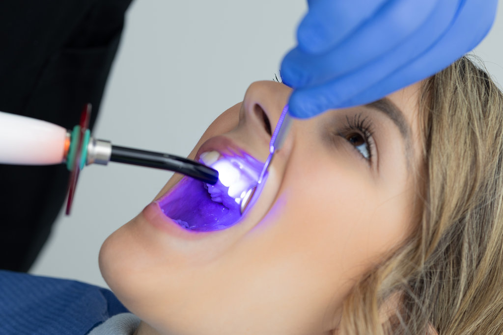 A dentist using a curing light on a patient's teeth during a dental procedure