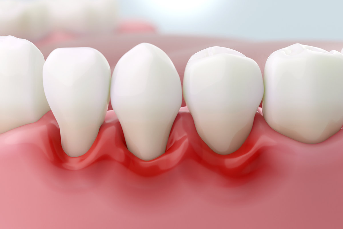 AdobeStock 873042942 - JAX Dental Studio